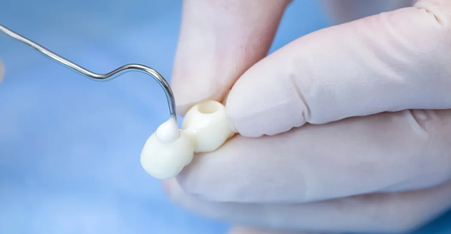 Dental Cement Allergy inblog